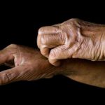 خارش پیری چیست و روش های  پیشگیری و درمان آن در سالمندان چگونه است؟